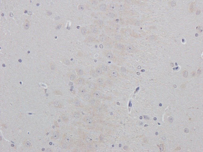 PDE2A antibody