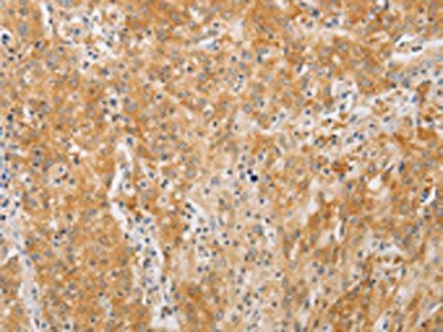 PDE4D Antibody