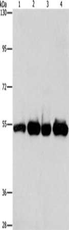 PDE4D antibody