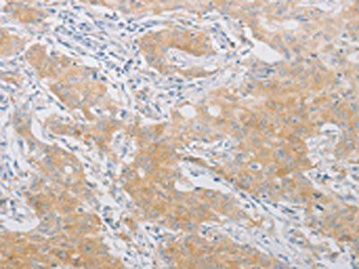 PDE4D Antibody