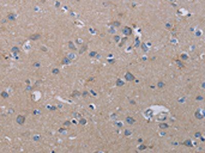 PDE4D Antibody