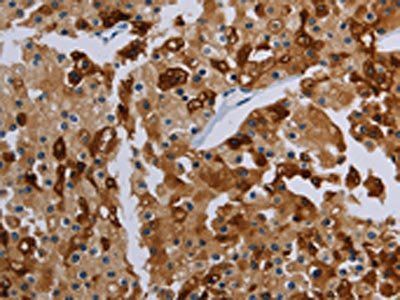 PDE4D Antibody