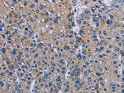 PDE4D Antibody