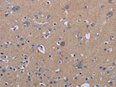 PDE4D Antibody