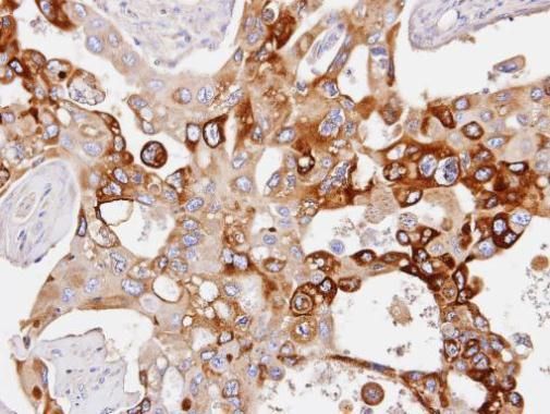 PDE4D antibody [C3], C-term