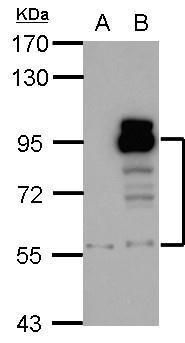PDE4D antibody [C3], C-term