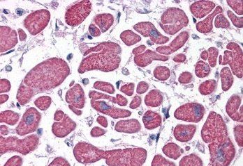 Goat anti-PDE4D Antibody