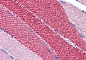 Goat anti-PDE4D Antibody