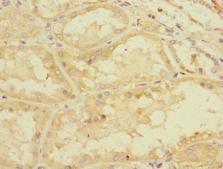 PDE4DIP Antibody