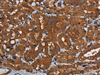 PDE5A Antibody