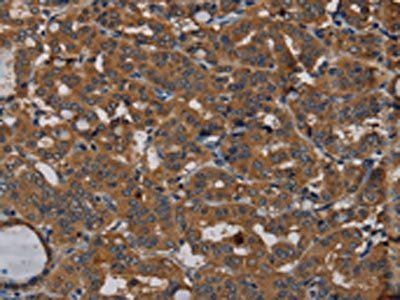 PDE5A Antibody