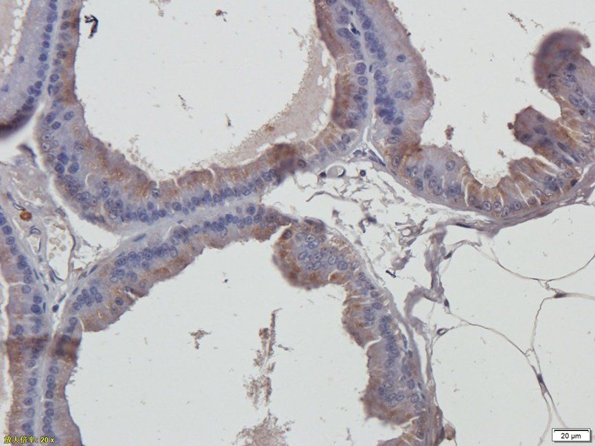 PDE5A antibody