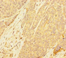 PDE6A Antibody