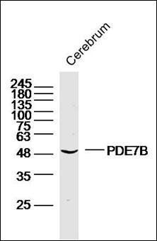 PDE7B antibody