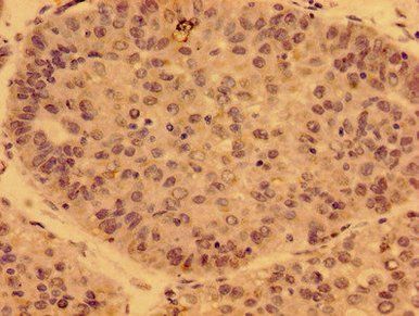 PDF Antibody
