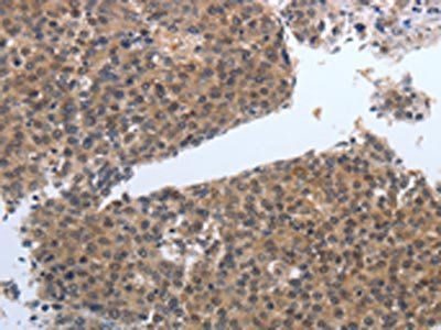 PDGFB Antibody