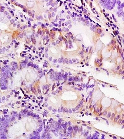 PDGFRA Rabbit Polyclonal Antibody (PE)