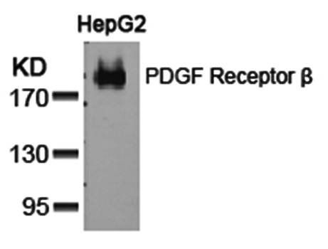 PDGF Receptor b Rabbit Polyclonal Antibody