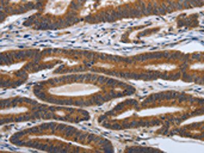 PDGFA Antibody