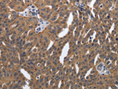 PDGFA Antibody