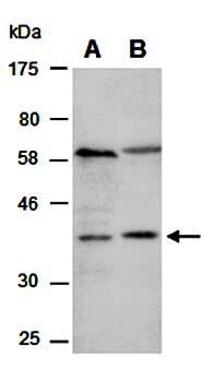 PDGFB (N) Antibody, Rabbit Polyclonal