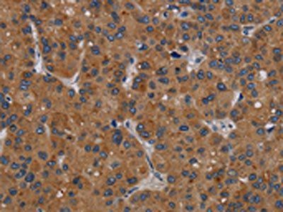 PDGFC Antibody