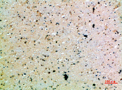 PDGFC Antibody