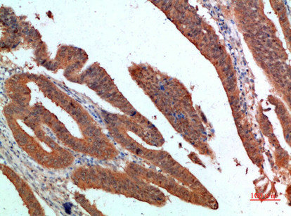 PDGFC Antibody