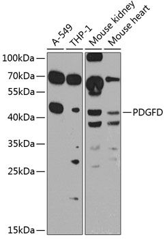 PDGFD antibody