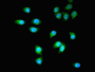 PDGFRB Antibody
