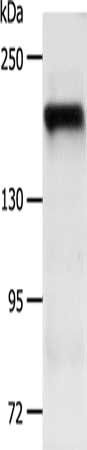 PDGFRB Antibody