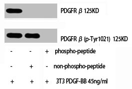 PDGFRB Antibody