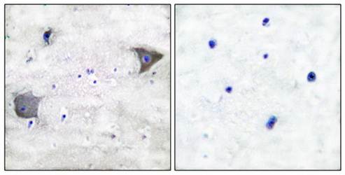 PDGFR alpha antibody