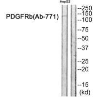 PDGFRB (Ab-771) Antibody