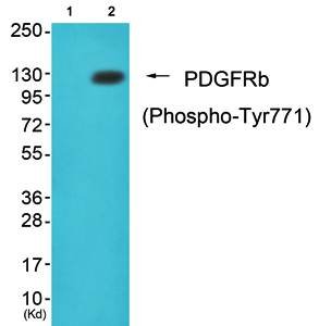 PDGFR beta (phospho-Tyr771) antibody
