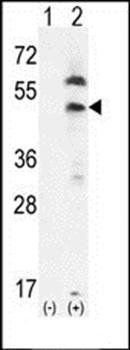 PDGFRL antibody