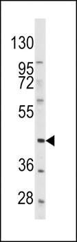PDGFRL antibody