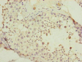 PDHA2 Antibody