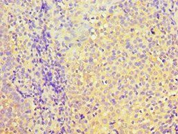 PDHX Antibody