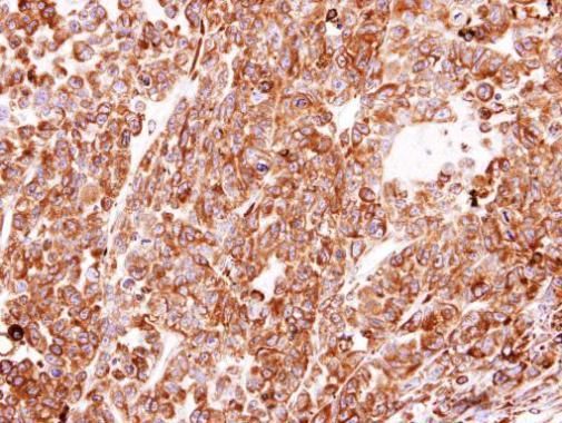 PDI antibody [N1N3]