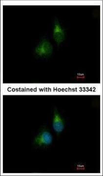 protein disulfide isomerase family A member 5 Antibody