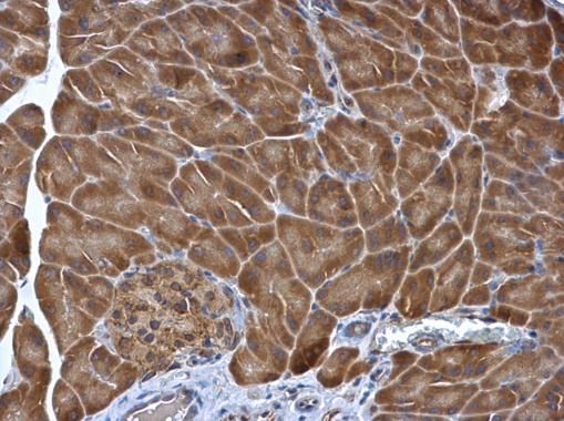 protein disulfide isomerase family A member 5 Antibody