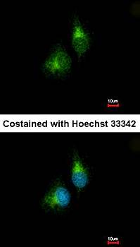 PDIR antibody