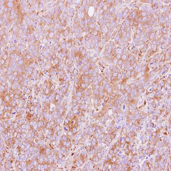 PDIR antibody