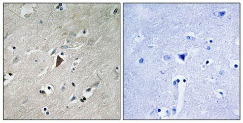PDK1 (Phospho-Tyr9) Antibody