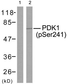 PDK1 (Phospho-Ser241) Antibody