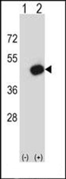 Pdk2 antibody
