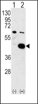 PDK2 antibody