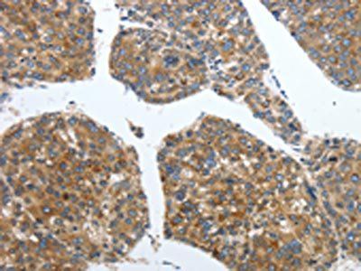 PDK2 Antibody