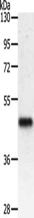 PDK2 antibody